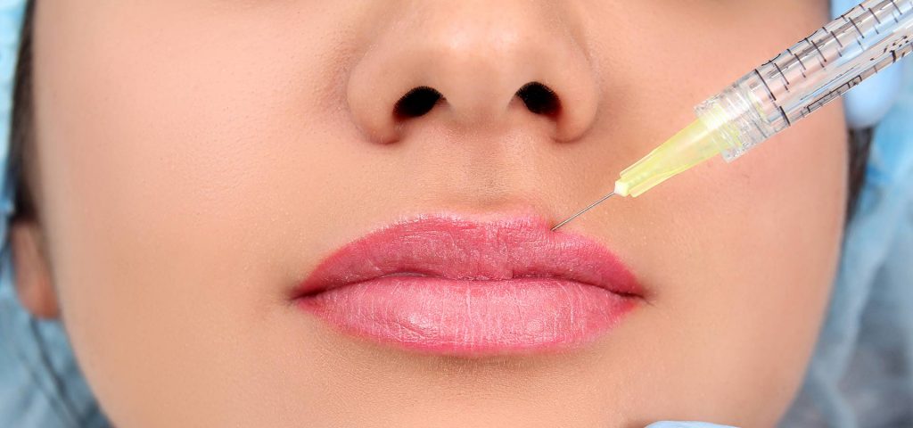 лучшие филлеры для губ рейтинг. корейский препарат для губ филлер. лучшие филлеры для губ рейтинг. лучшие филлеры для губ рейтинг. Juvederm ultra 3 0.